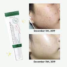 AXIS-Y dark-spot-correcting-glow-serum , 50ml