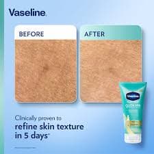 VASELINE GLUTA HYA SMOOTHING PERFECTOR LOTION 300ML