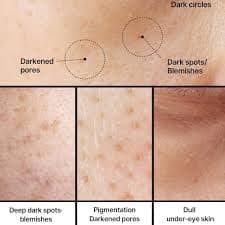 CELIMAX PORE + DARK SPOT BRIGHTENING CREAM