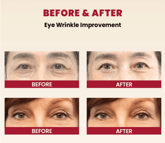 KSECRET - SEOUL 1988 Eye Cream : Retinal Liposome 4% + Fermented Bean, 30ml