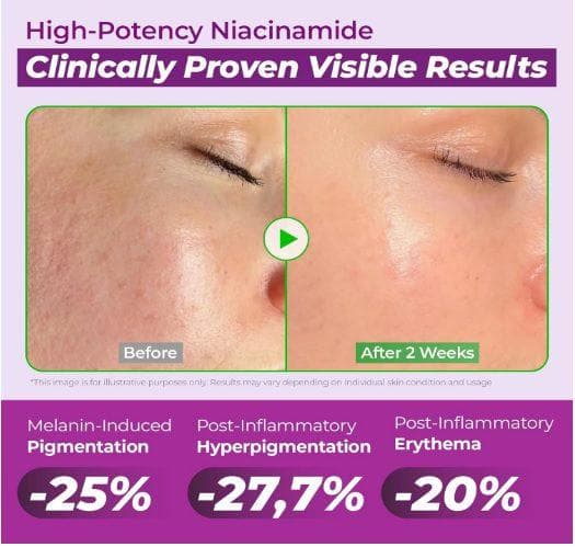 JUMISO Niacinamide 20 Serum 40ml