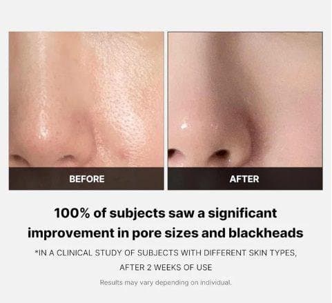 MEDICUBE ZERO PORE PAD - 70 PADS