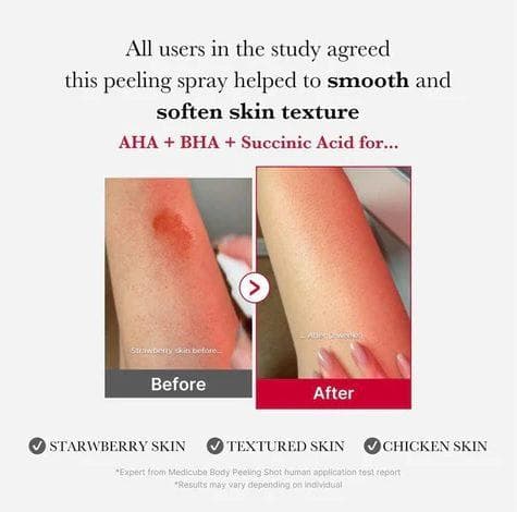 medicube red acne body peeling shot 110g