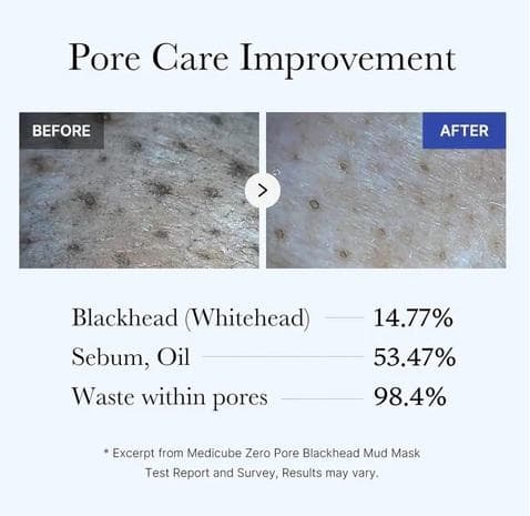 Medicube Zero Pore Blackhead Mud Mask - 100g