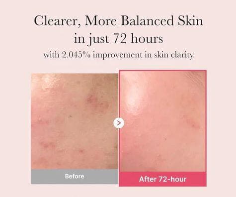 medicube TXA+Niacinamide 15 Serum 30ml