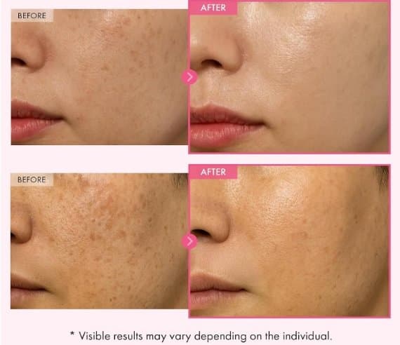 TOSOWOONG Arbutin 7% Glutathione Cream 50g