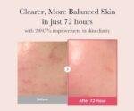 medicube TXA+Niacinamide 15 Serum 30ml - Image 2